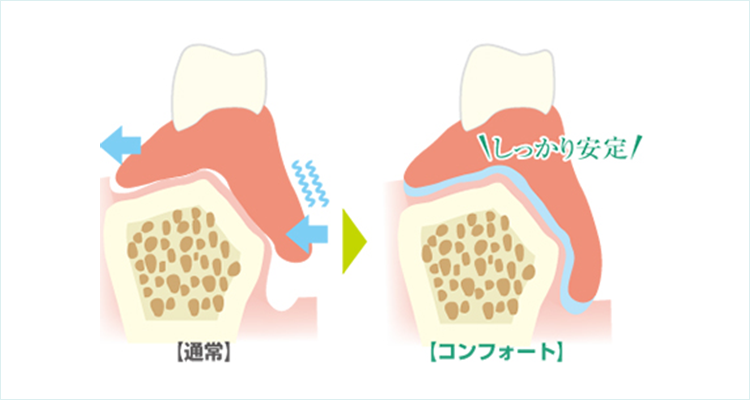 お口の中でがっちり固定 安定して外れにくい