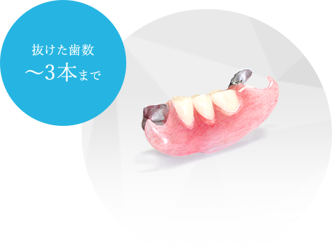 抜けた歯～3本まで