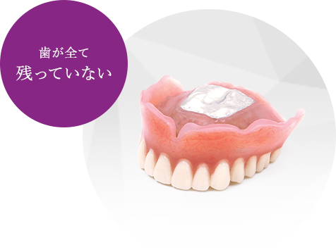 歯が全て残っていない