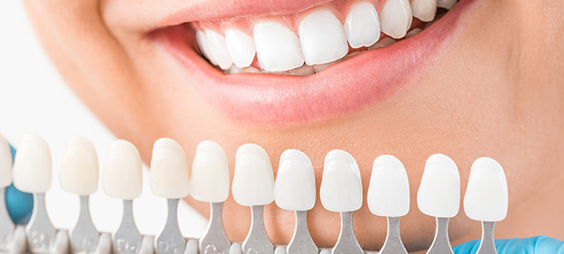 矯正歯科はもちろんホワイトニングやむし歯治療も可能